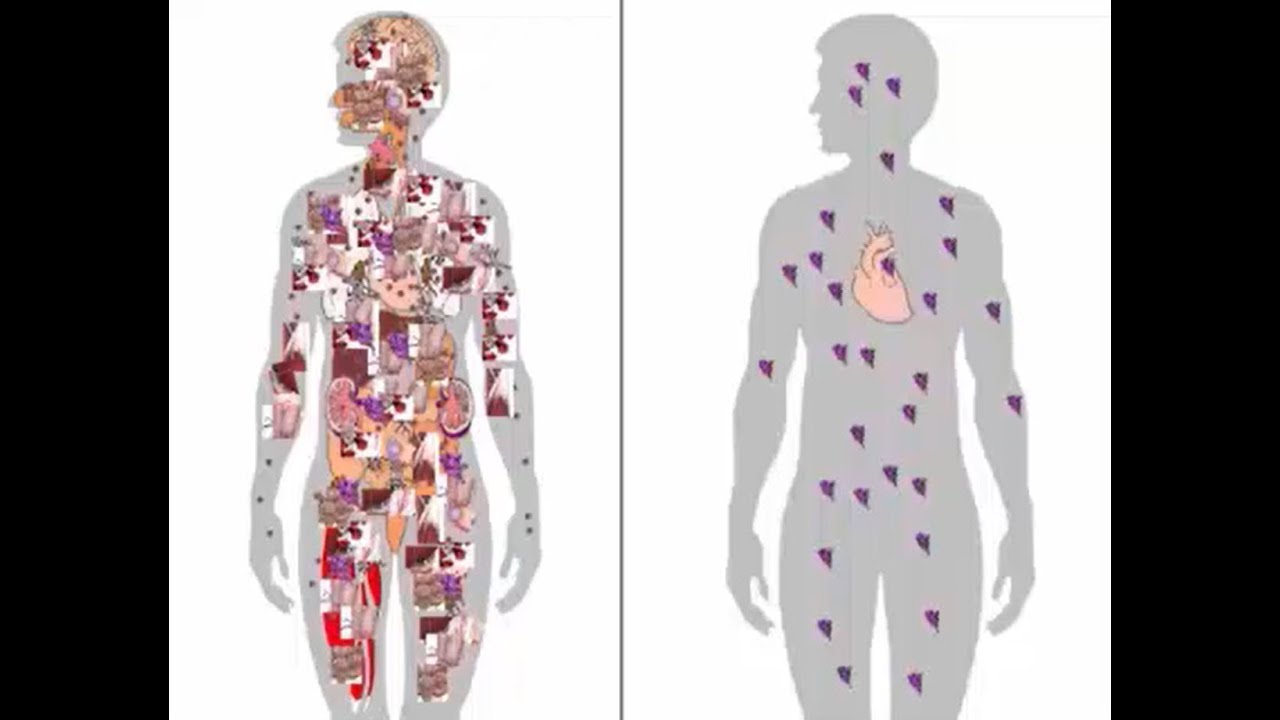 The Moderna mRNA Vaccine & Immune System Side Effects