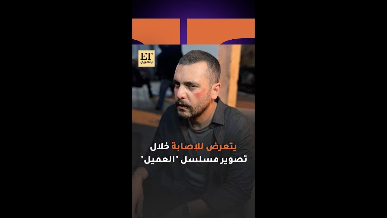 ♨️ سامر إسماعيل يتعرض للإصابة خلال تصوير مسلسل العميل