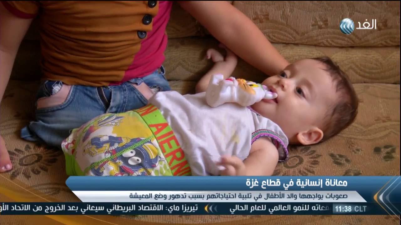3 أطفال في غزة ولدوا بنصف جسد وبلا أطراف سفلية
