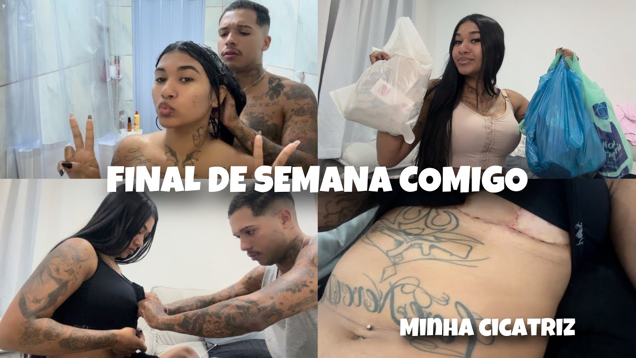 UM FINAL DE SEMANA COMIGO - COMPRINHAS + MOSTREI A MARCA DA CIRURGIA