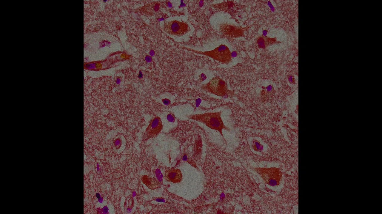 Fatih Tuter - Neurogentle