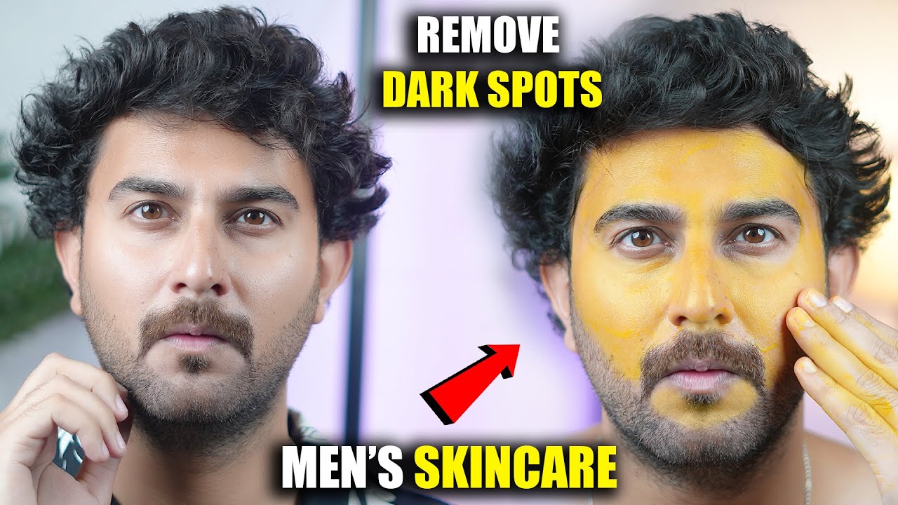 Remove Dark Spots & Pigmentation Naturally | Men’s Skincare Routine | Home Remedy | DSBOSSKO