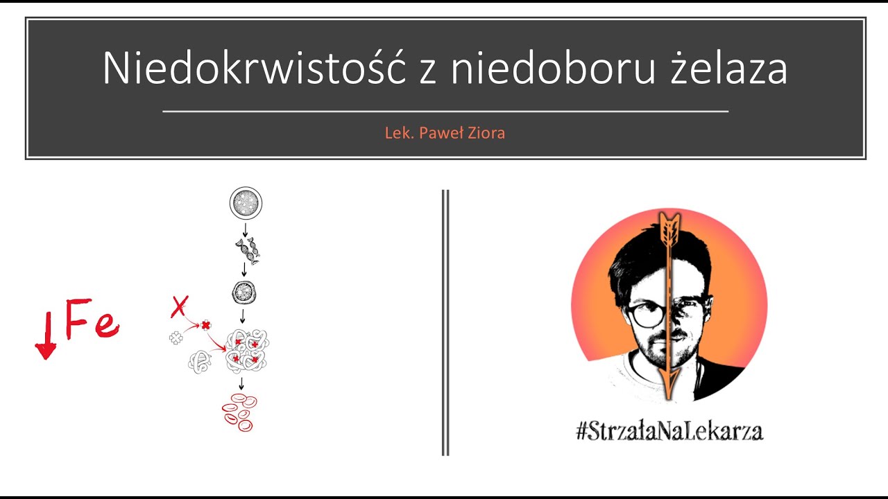 Niedokrwistość z niedoboru żelaza