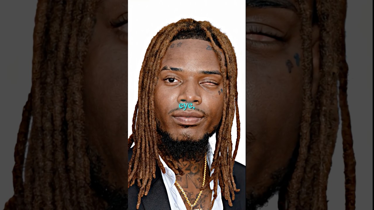fetty wap almost lost both eyes? 🥺💔