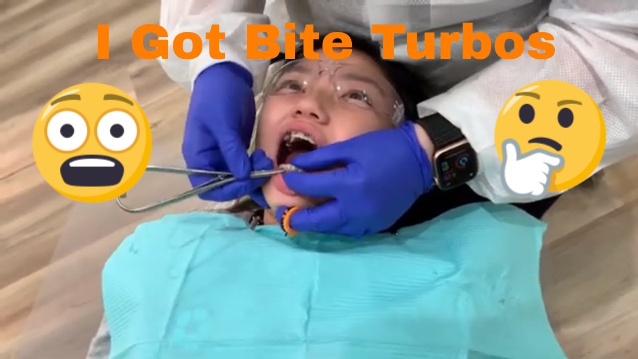 Kaelyn Gets Braces  Update # 1 | Bite Turbos