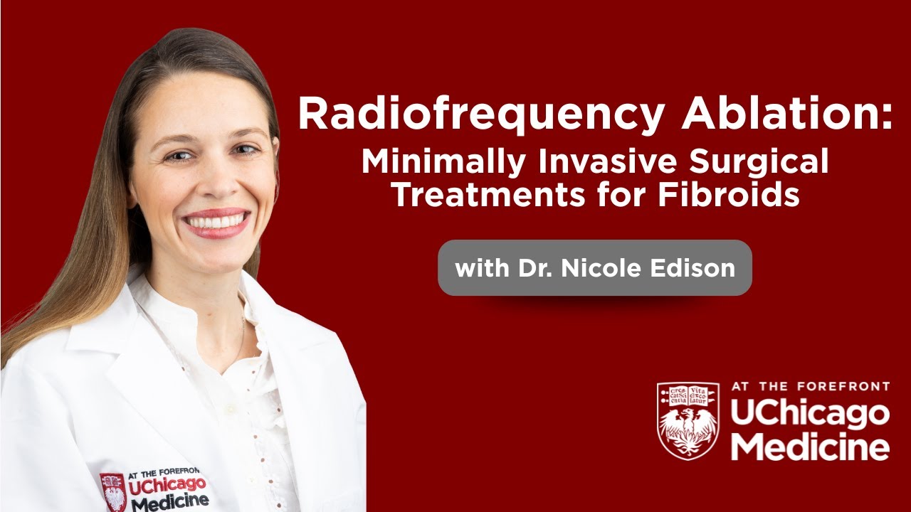 Minimally Invasive Fibroid Treatment: Acessa & Sonata at UChicago Medicine with Dr. Edison  |  CATeR