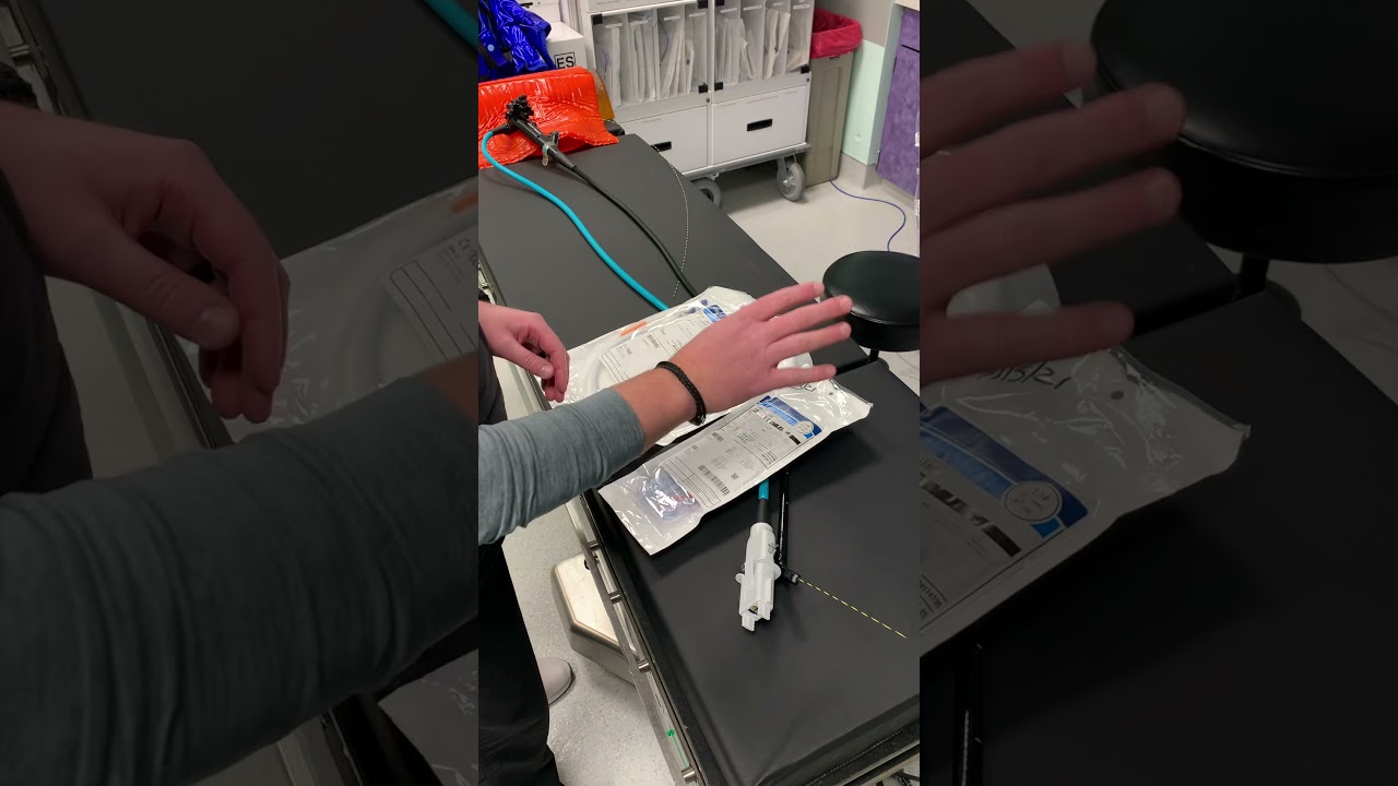 ERCP - Double Pigtail Stent