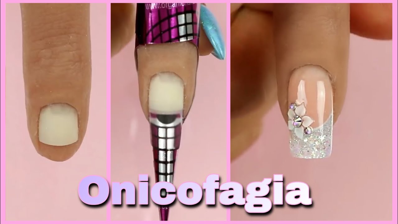 ONICOFAGIA UÑAS ESCULPIDAS 💅🏻✨ FRENCH PERMANENTEMENTE Y 3D