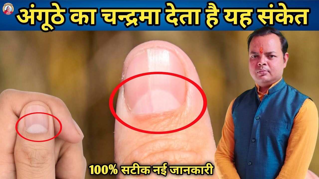 अंगूठे पर चाँद का निशान | moon mark on Thumb | अंगूठे पर चंद्रमा होना एक बहुत बड़ी बात है | 