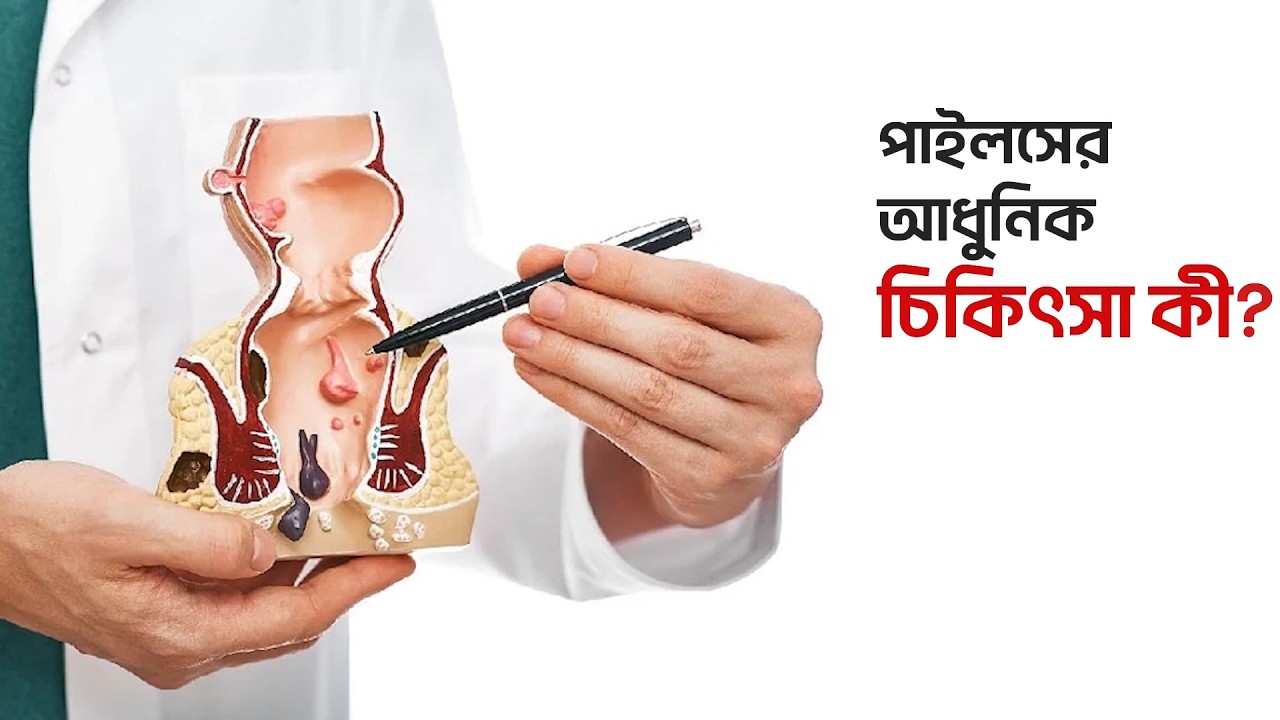 পাইলসের আধুনিক চিকিৎসা | Prof. Dr Md Rashidul Islam