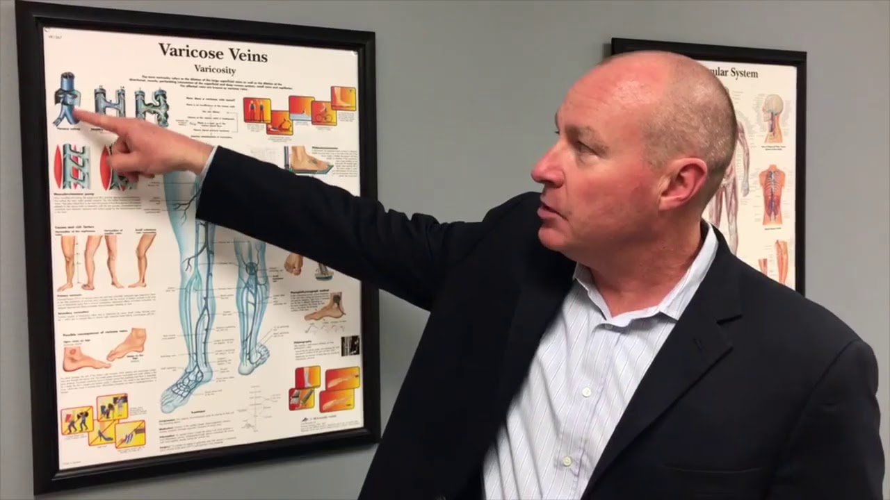 How Leaky Vein Valves Lead to Varicose Veins  (Andrew Jones, MD)