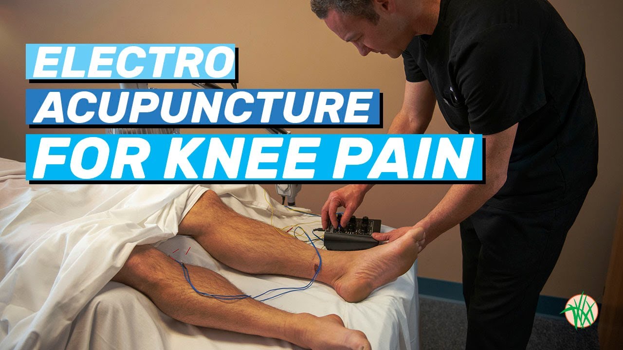 Electroacupuncture for Knee Pain