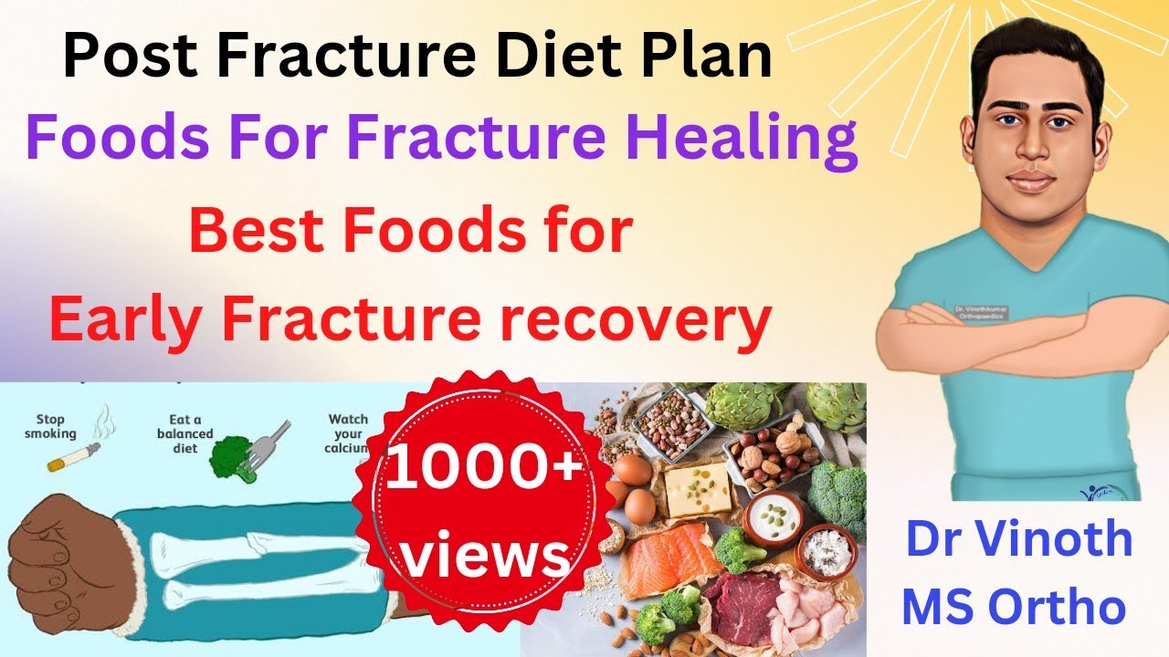 Fracture healing Foods|Post Fracture diet plan |Foods for Early fracture recovery|Bone healing foods