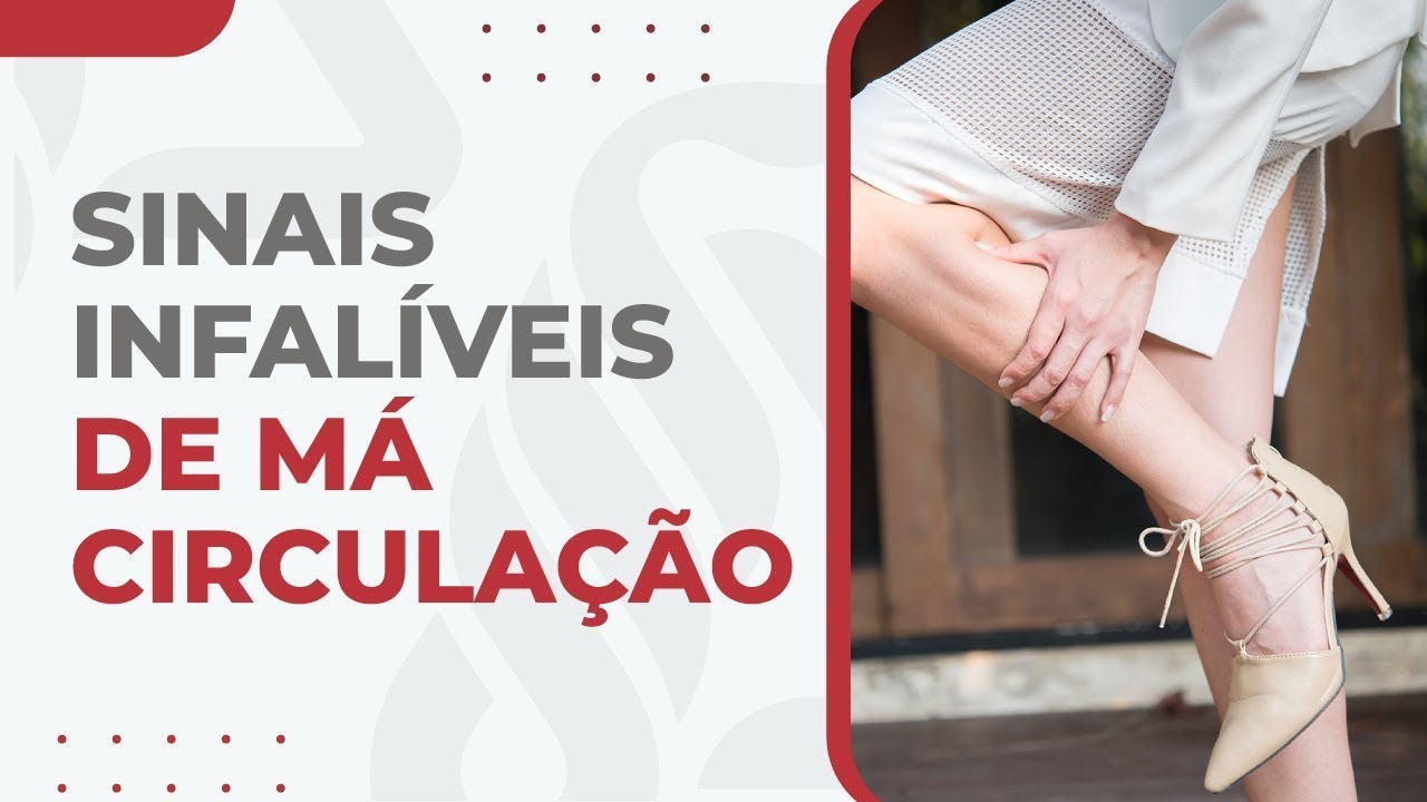 Quais São os Sinais de Má Circulação? Má circulação sintomas que o cirurgião vascular procura.