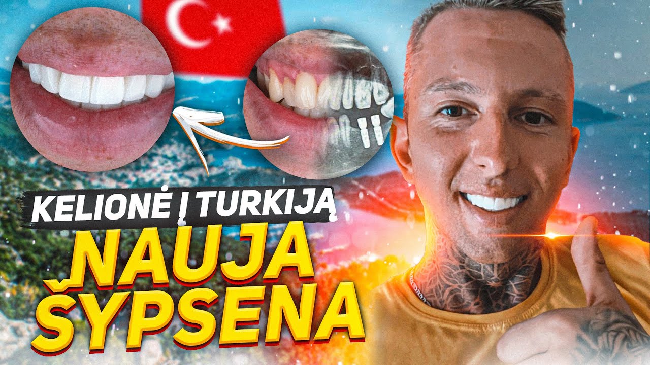 Remigijus Viršila Kelionė į Turkija/Operacija Ir Nauja Šypsena