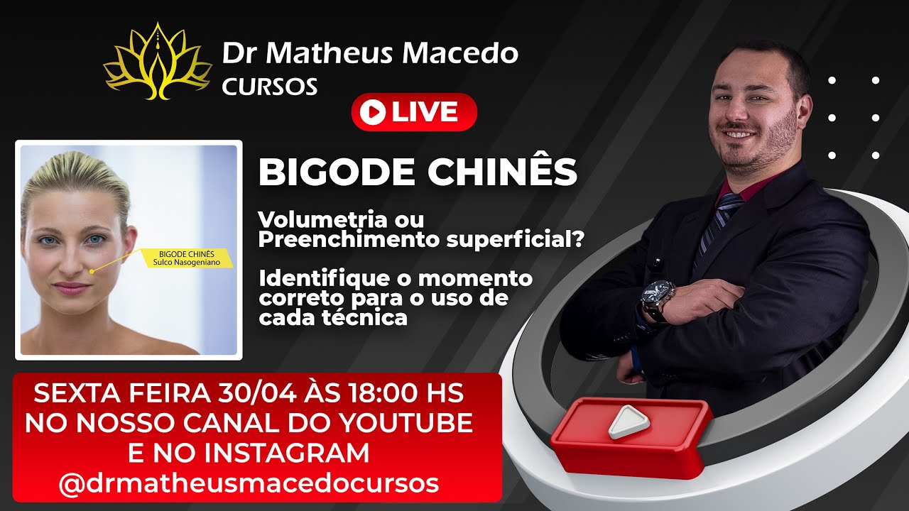 Bigode Chinês - Volumetria ou Preenchimento superficial