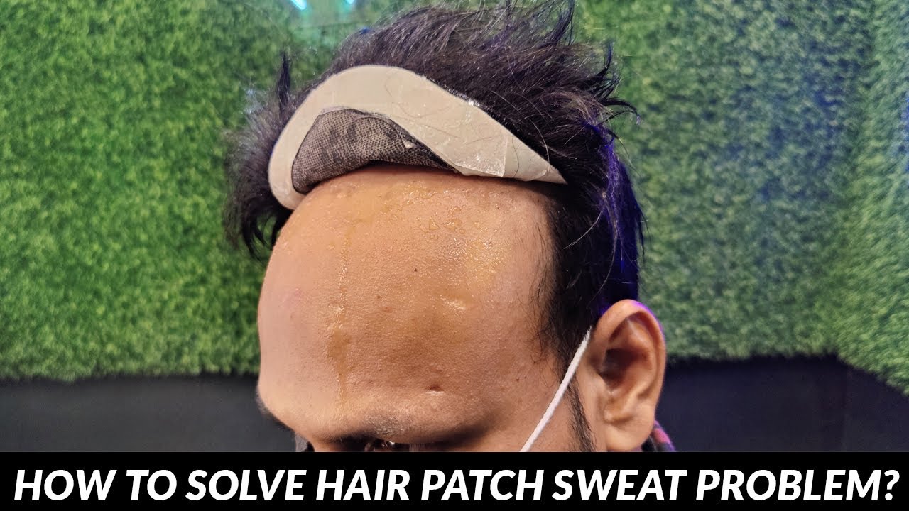 Hair Patch and Sweating | sweating in a hair patch | Front Tape loose in 15 Days problem solved ?