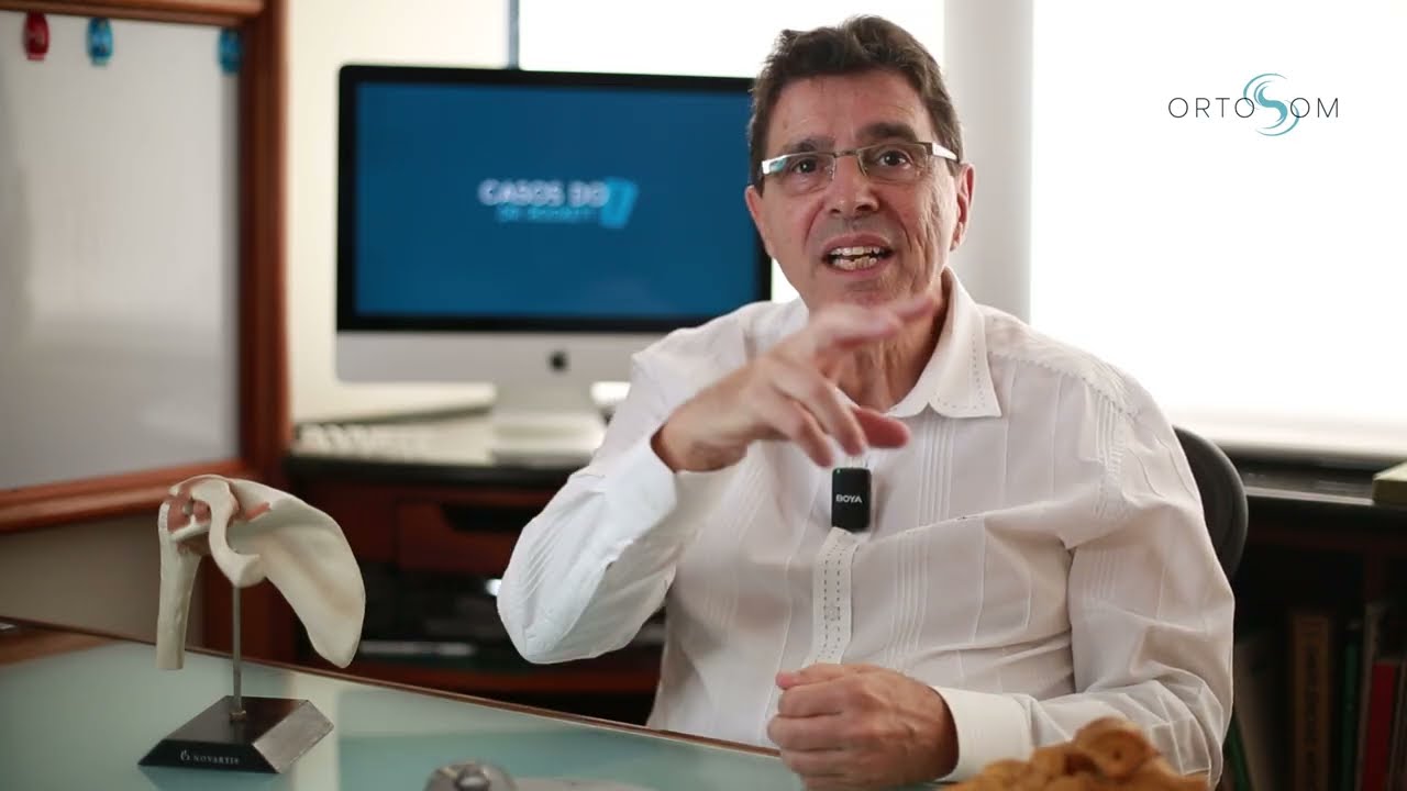 Artrose e calcificação no ombro: é possível tratar sem cirurgia? Veja este caso real
