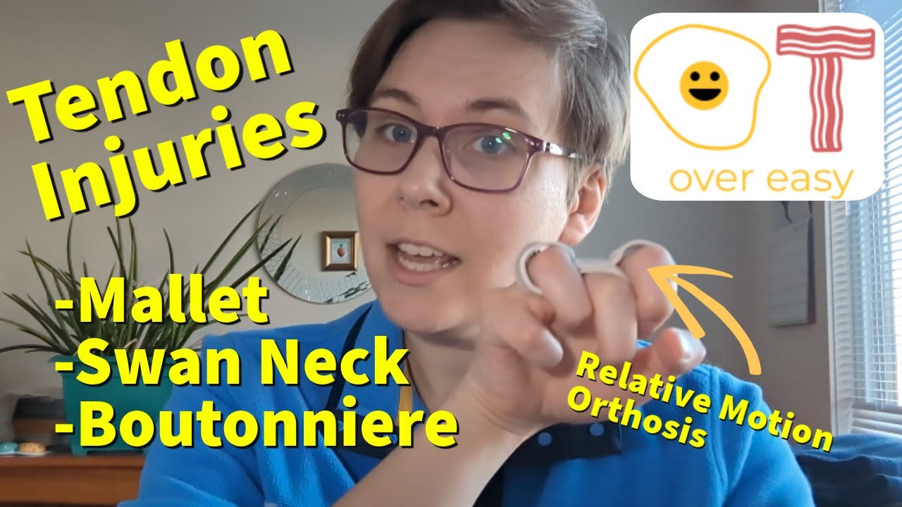 Splints (Part 4) - Flexor and Extensor Tendon Injuries