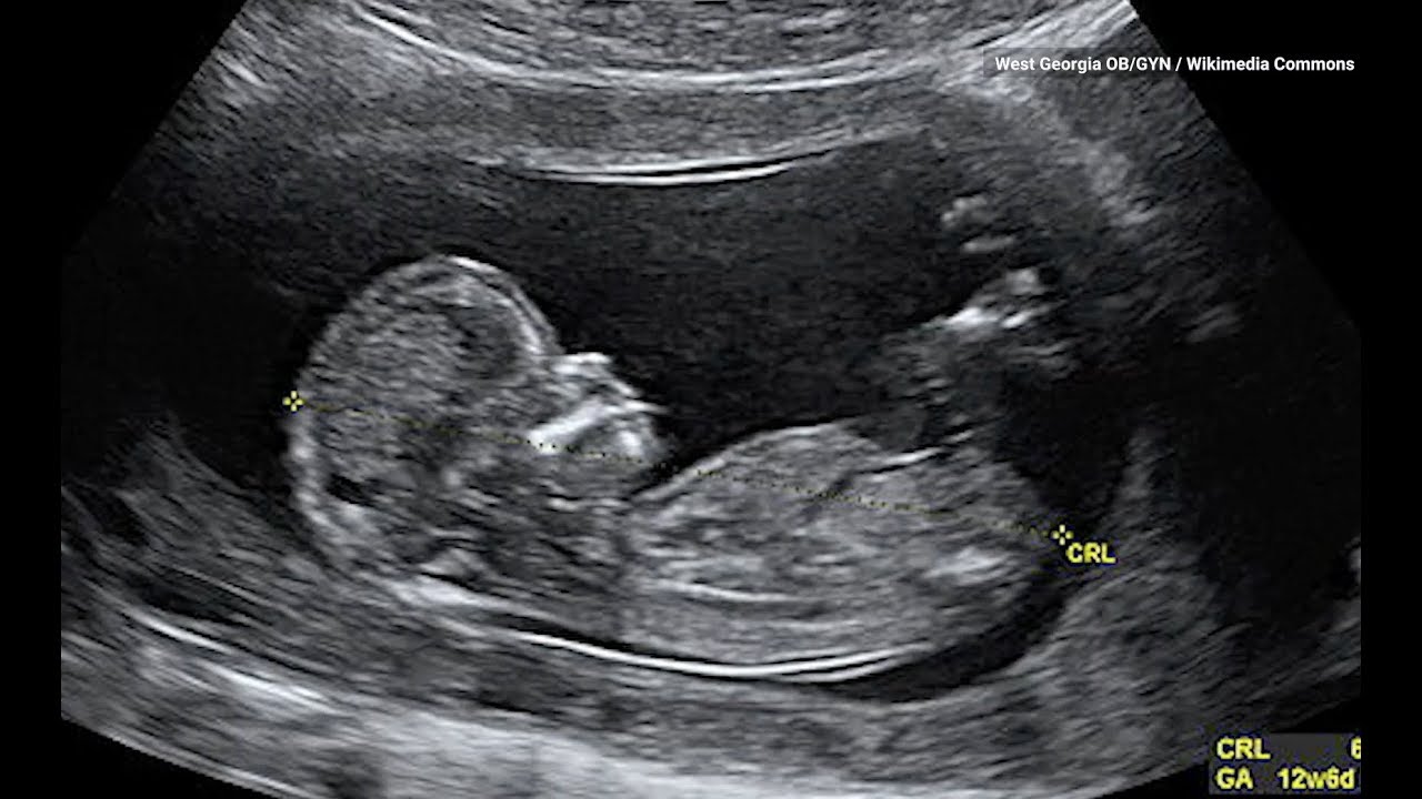 This is What Babies Kicking in the Womb are Really Doing