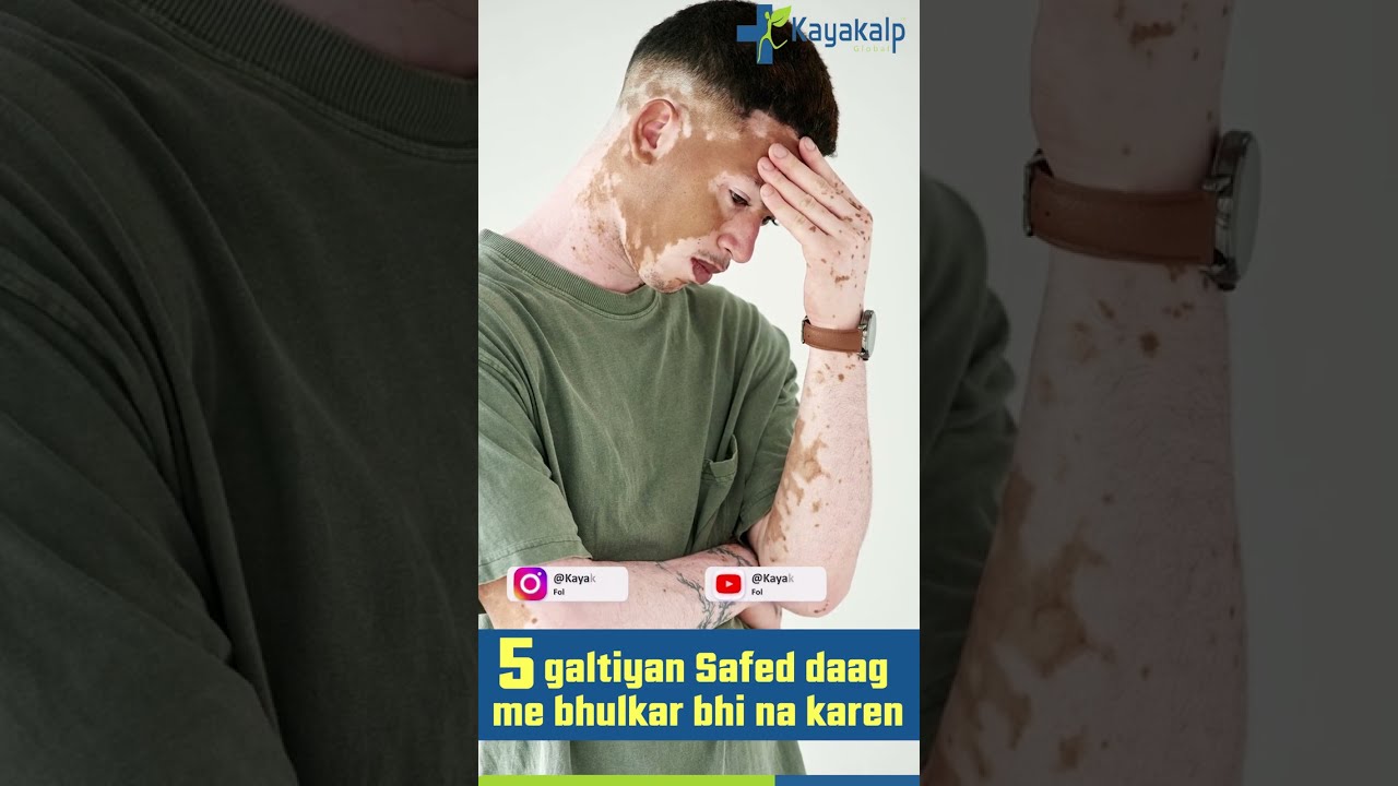 5 गलतियां सफेद दाग में भूलकर भी न करें  #shorts