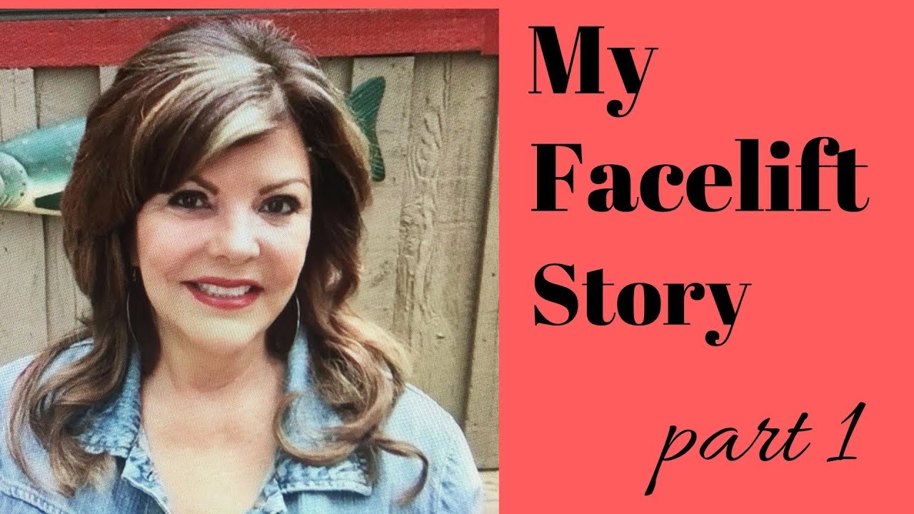 MY Facelift Story Part 1