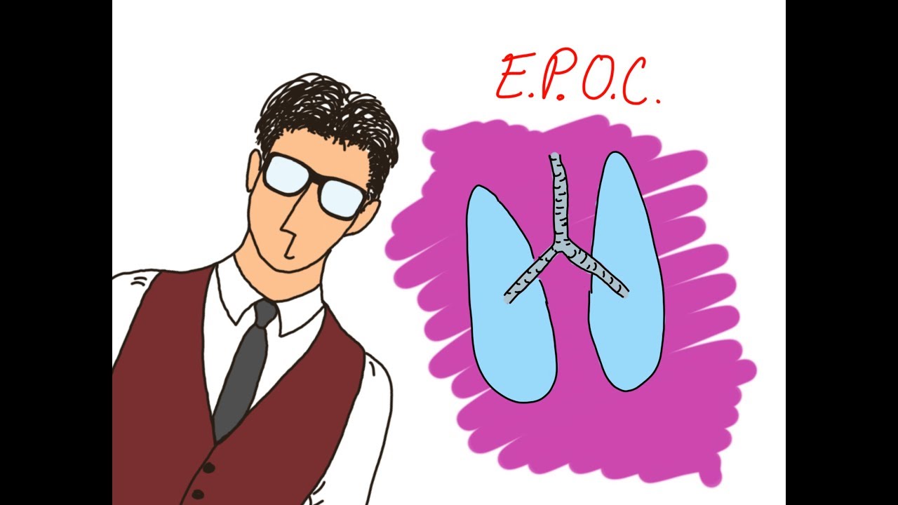 EPOC COMO NADIE TE LO HA EXPLICADO!