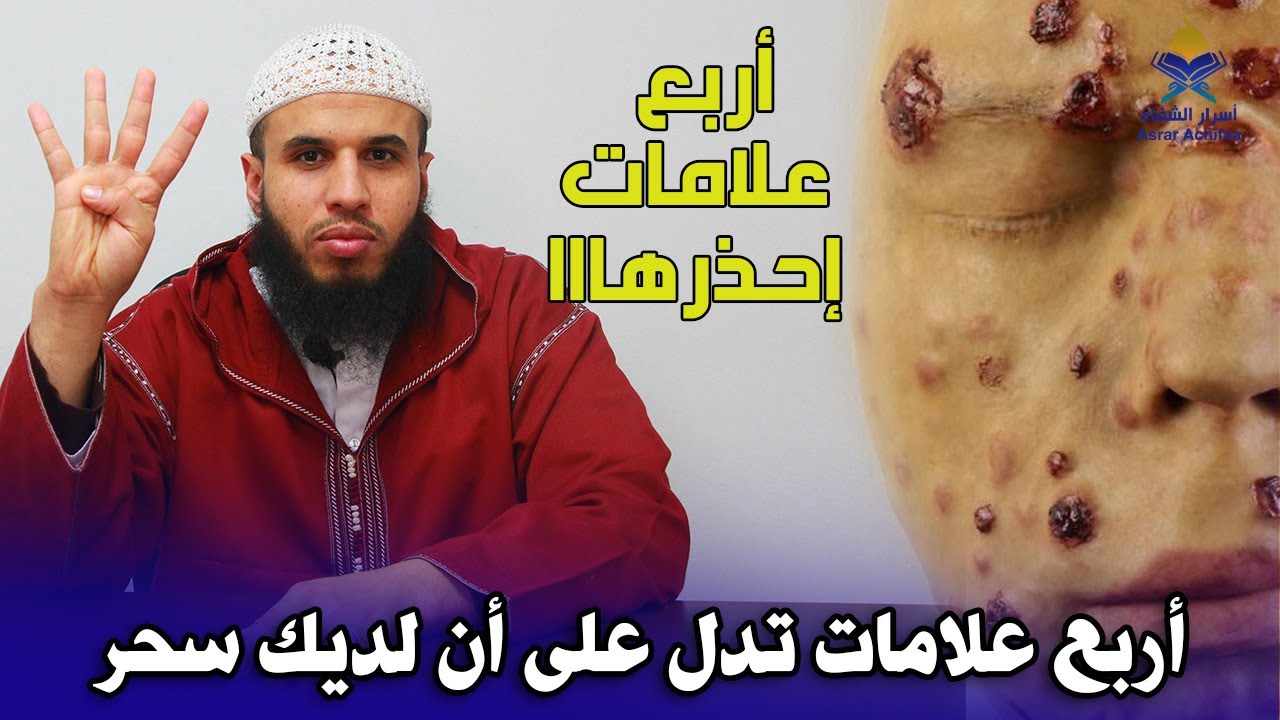 أربع علامات تدل على أنك مصاب بالسحر الاسود