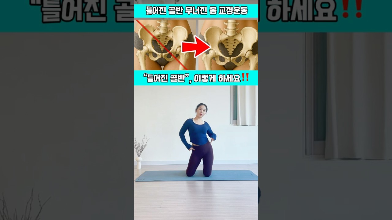 틀어진 골반에는 이 “동작”하세요‼️