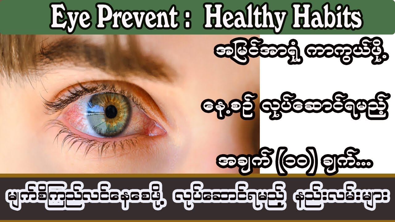 အမြင်ကြည်လင်ဖို့ နေ့စဉ်လုပ်ဆောင်နိုင်တဲ့ နည်းလမ်းများ - Eye Prevent : healthy habits
