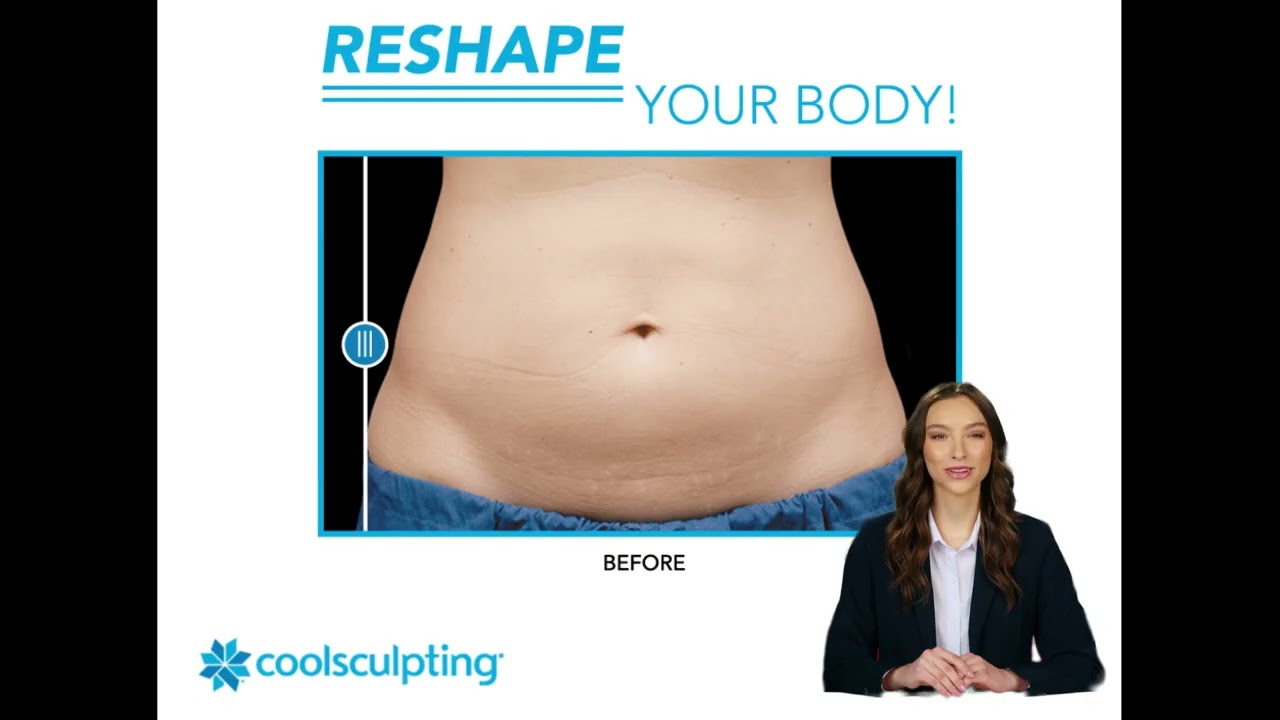 Body Contouring in St Clair Shores | True Laser Spa