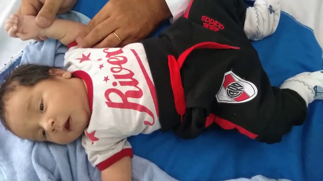 Ejercicios para bebe con PBO lesión del Plexo Braquial o Parálisis Braquial Obstetrica