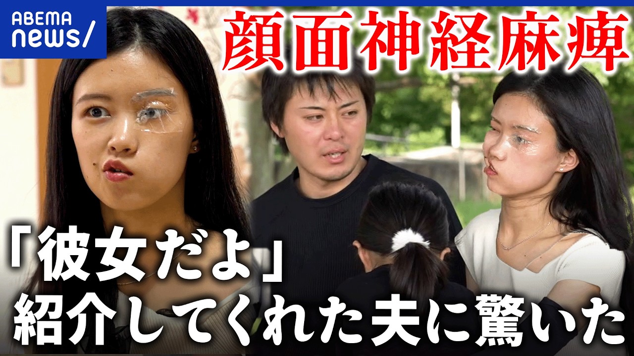 【顔面神経麻痺】14歳で「見た目」が変わって…悲観的だった彼女が明るく前向きなれたワケ│アベプラ