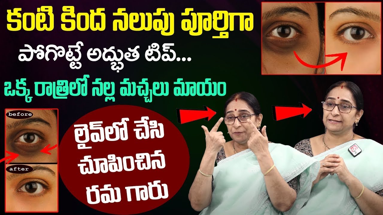 Ramaa Raavi - How To Use Natural Ingredients To Get Rid Of Dark Circles & Wrinkles || SumanTV Women