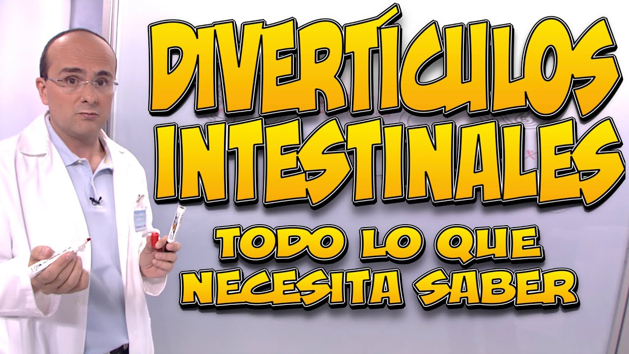 DIVERT&Iacute;CULOS INTESTINALES - Todo lo que necesita saber
