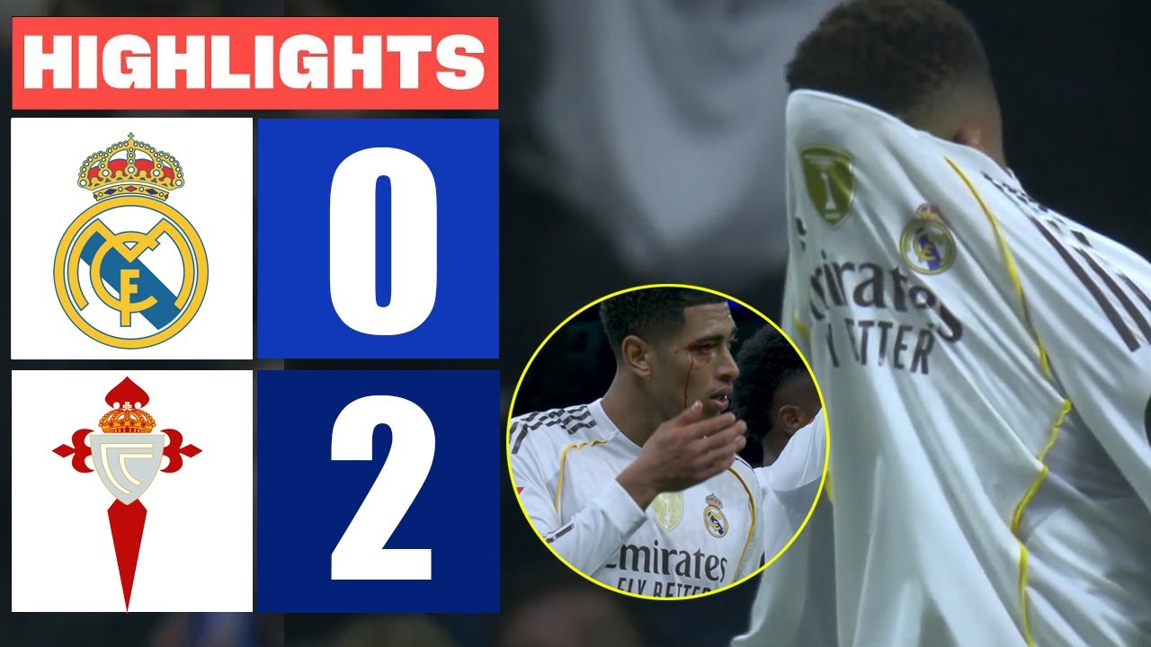 Real Madrid vs Celta Vigo 0-2 Full Highlights (English Commentary)