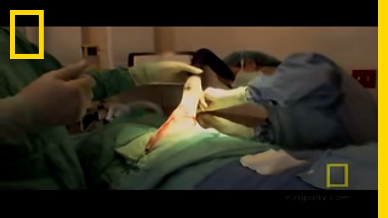 Three-Legged Dog | National Geographic