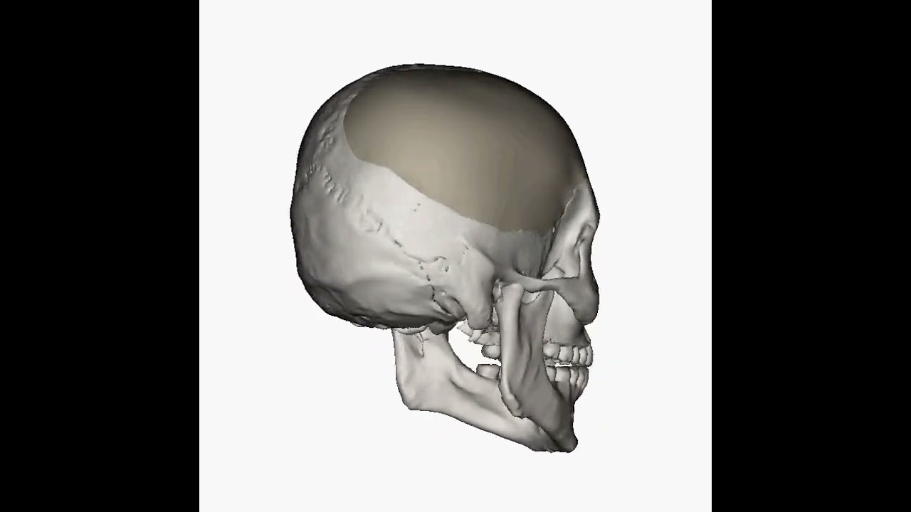 Meraky Craneo 3d