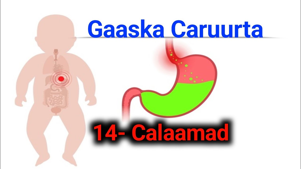 14- Calaamad -- Gaaska Caruurta nooca lagu qaldo Burukiitada iyo caabuqa quuman waa...see...more...