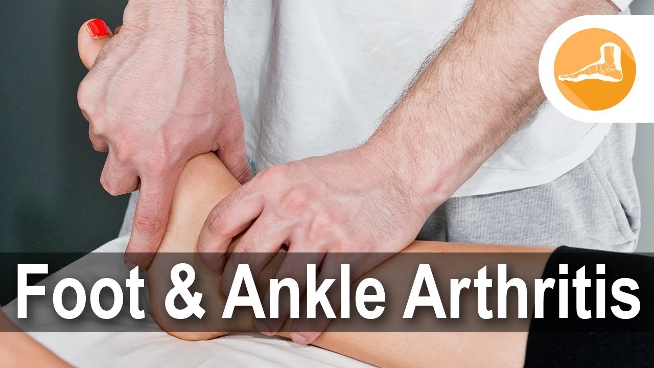 Foot & Ankle Arthritis - Erik Nilssen, MD
