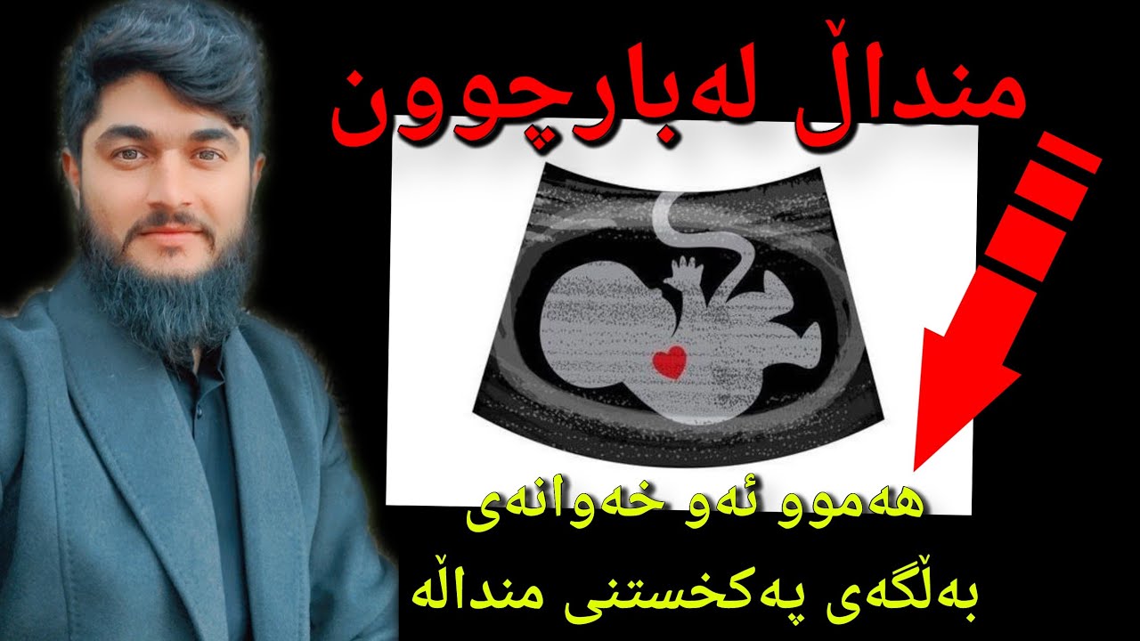 منداڵ لەبارچوون // #وەڵامی_خەو