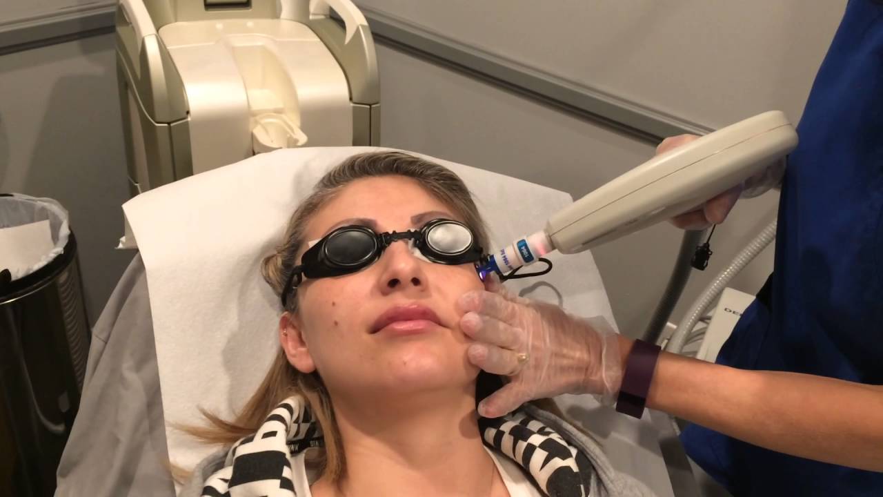 Clear Lift Eye Treatment - Results May Vary