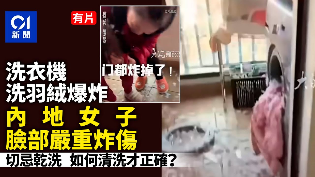 【01秒看新聞】用洗衣機洗羽絨爆炸！內地女臉部嚴重炸傷 1分鐘學如何保命｜01新聞｜洗衣機｜爆炸｜羽絨｜保命｜毀容