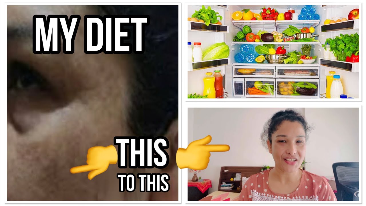 My diet for Melasma/ pigmentation/ no fake talk honest diet.