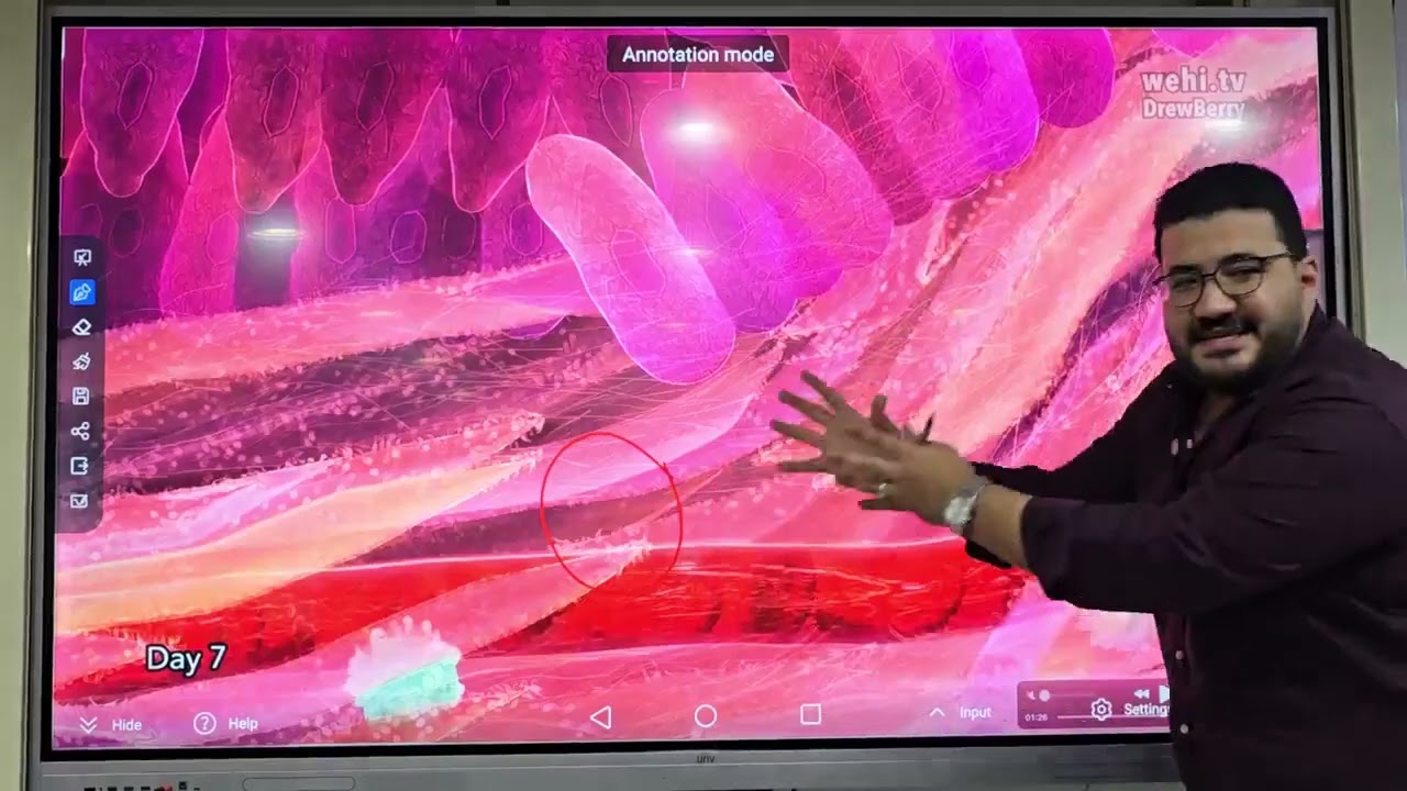 Vascular Events Of Acute Inflammation- الاسكندريه