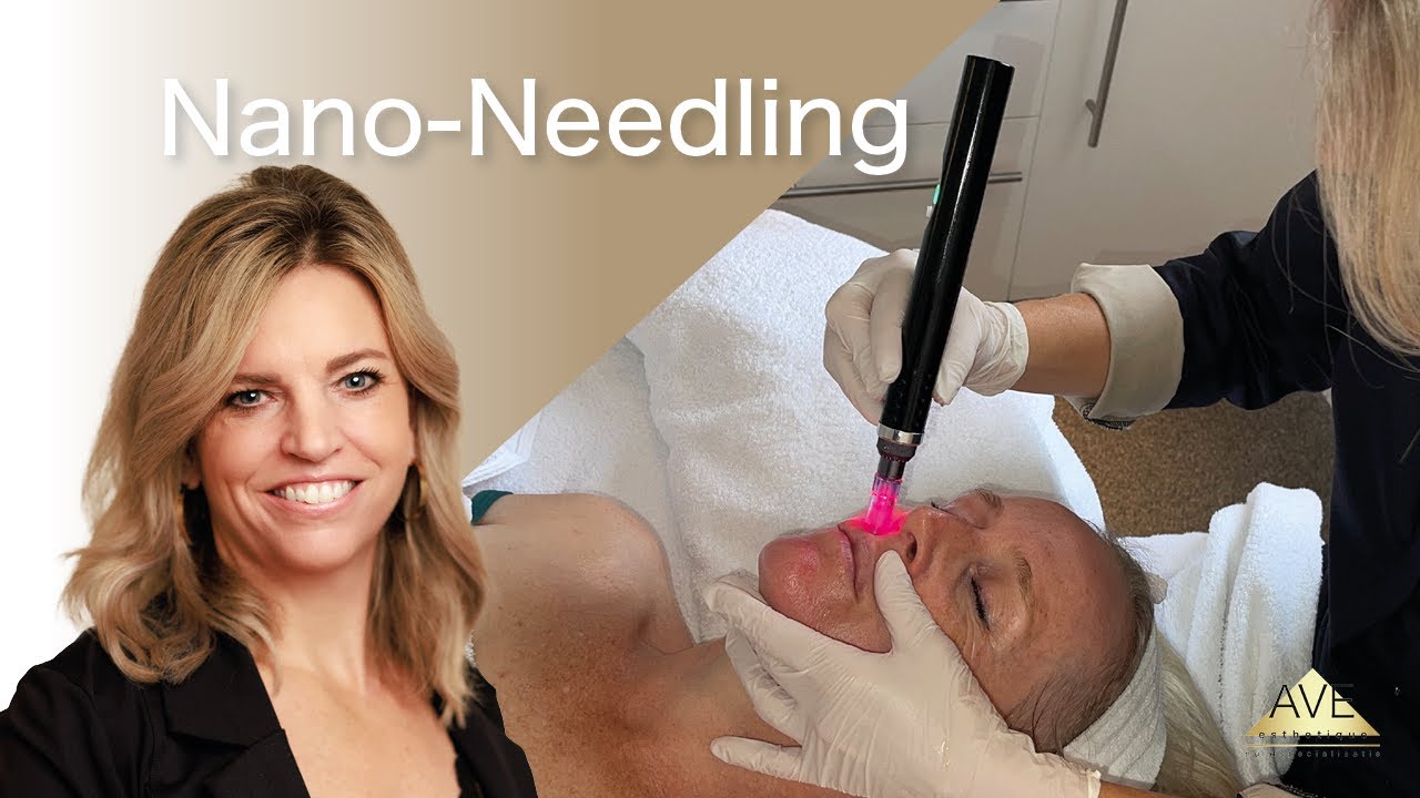 Glow up met Nano-Needling | AVE Huidkliniek