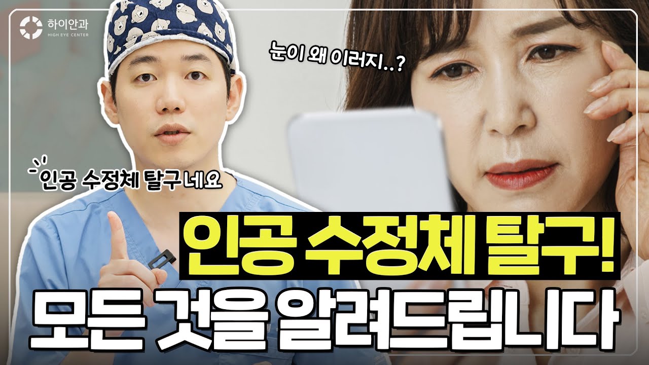 👨&zwj;⚕️인공수정체탈구?? 이 영상하나로 종결👀 백내장재수술│유리체절제술│공막고정술