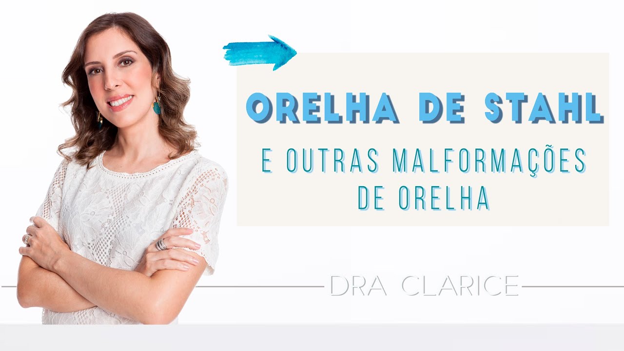 Dra Clarice Abreu - Orelha de Stahl e Outras Malforma&ccedil;&otilde;es | Macrotia, Criptotia, Orelha Constricta