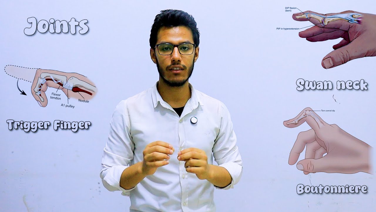 OSCE From A to Z - Rheumatological examination | Dr Ahmed Mostafa