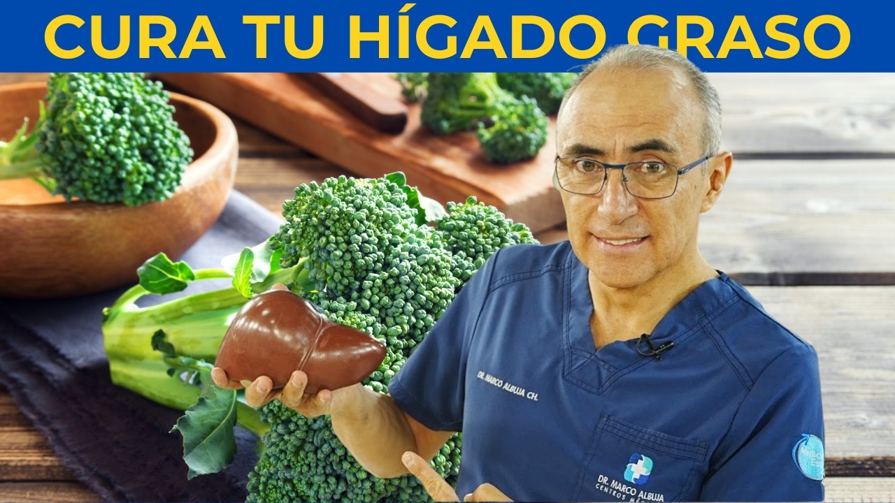 🥦 Vence al Hígado Graso: El Mejor Tratamientos y una Dieta Efectiva - DIRECTO